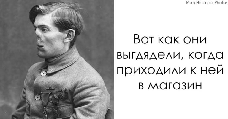 Невероятные фото ″До″ и ″После″ ветеранов, которым она ″восстановила″ лица