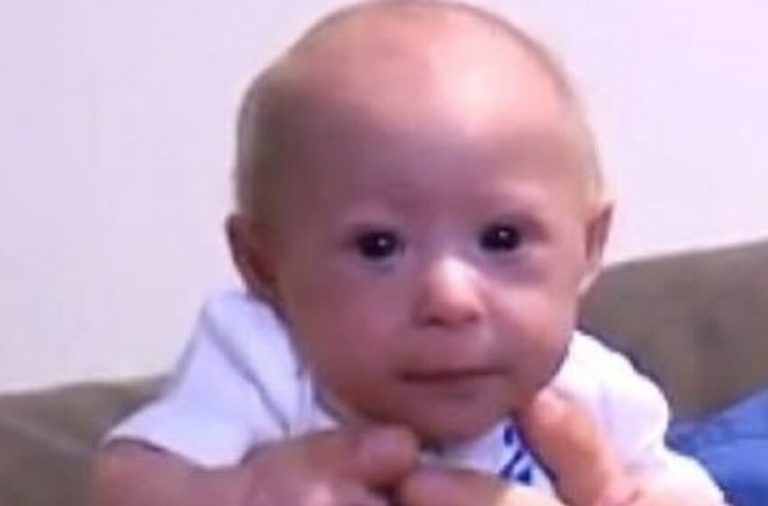 He’s 7 months old but looks like a newborn! This baby’s story has become known around the world
