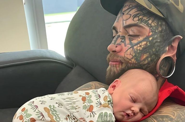 A father with over 200 tattoos is removing them for his daughter. What does he look like now without them?