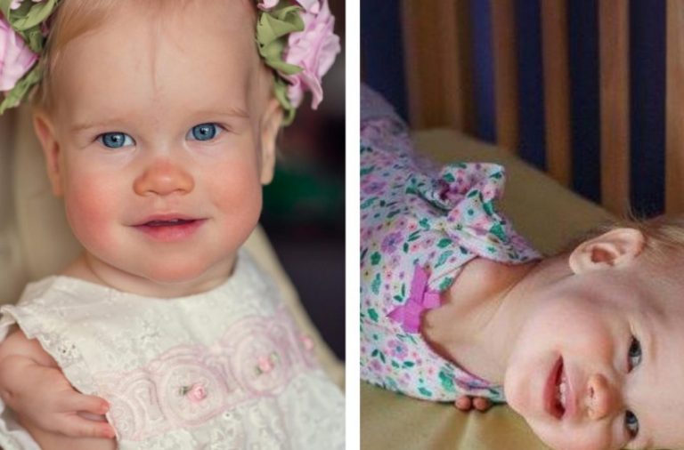 An adoptive family gave warmth and love to a girl born with physical differences
