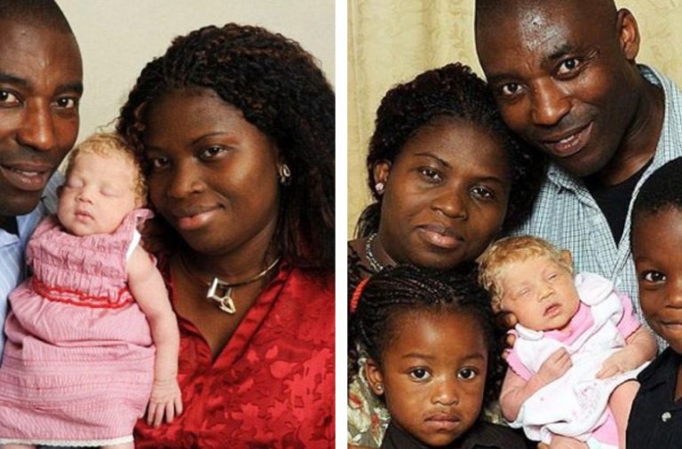 What does the “Snow White” girl born into a Nigerian family 10 years ago look like today?