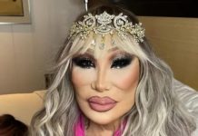 Она была иконой телевидения, которой восхищались миллионы: узнаете ли вы её после всех операций?