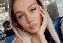 «Жжет все тело! Опухает лицо!»: Седокова пожаловалась на обострение болезни