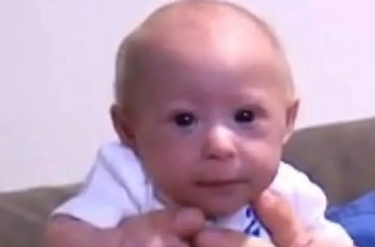 He’s 7 months old but looks like a newborn! This baby’s story has become known around the world