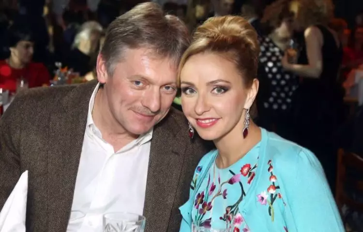 Лицо 30-летней в 50 лет! Фанаты заподозрили Навку в пластике