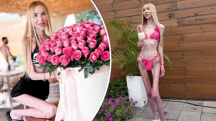 23-килограммовая блоггерша Алина Липницкая испугала сеть своим видом на новом фото