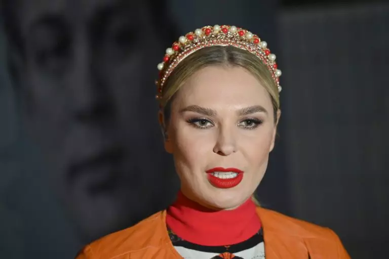 Пелагея открыто рассказала о проблемах с лицом и жёстких методах похудения